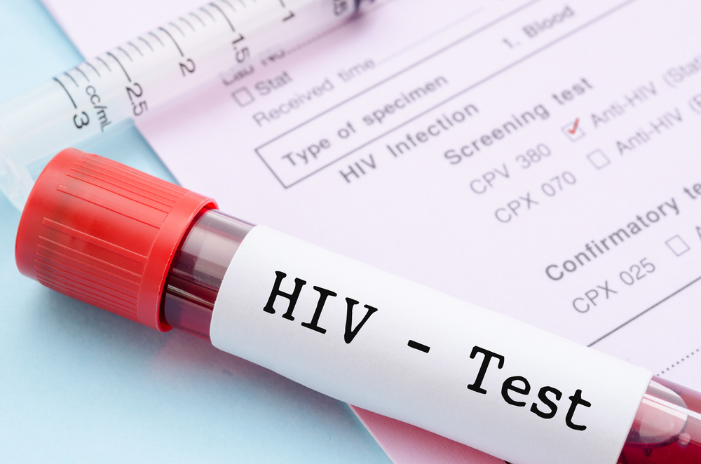Zda jste se nakazili HIV zjistíte podle testu z krve